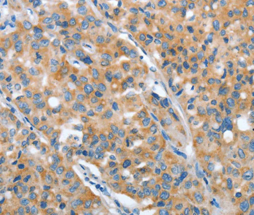 ARFGAP1 Polyclonal Antibody - image 1