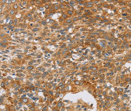 CRELD2 Polyclonal Antibody - image 1