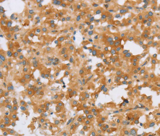 CRELD2 Polyclonal Antibody - image 2
