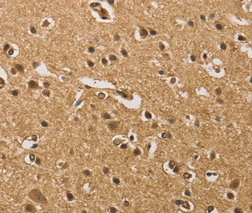 PRDM14 Polyclonal Antibody - image 1