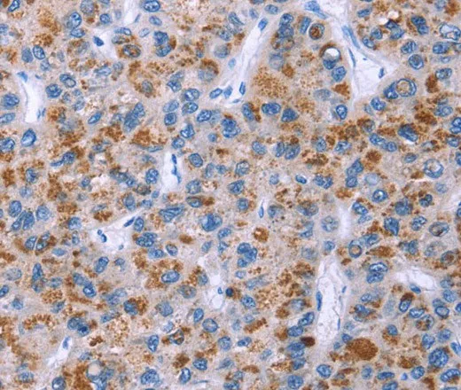 ESPL1 Polyclonal Antibody - image 1