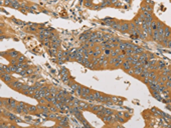 XPR1 Polyclonal Antibody - image 1