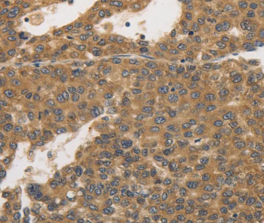 PRKD1 Polyclonal Antibody - image 1