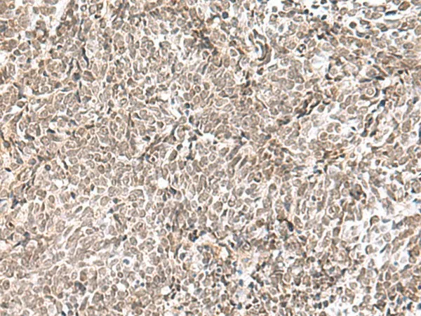 ELAC1 Polyclonal Antibody - image 1