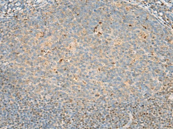 DNPEP Polyclonal Antibody - image 1