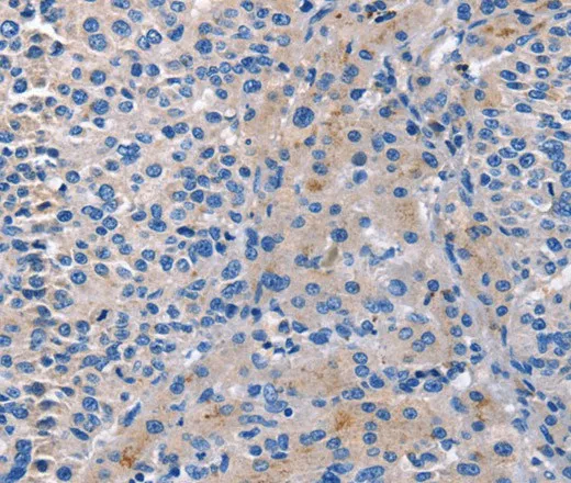 CD5L Polyclonal Antibody - image 1