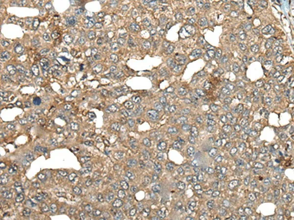 BRD9 Polyclonal Antibody - image 1