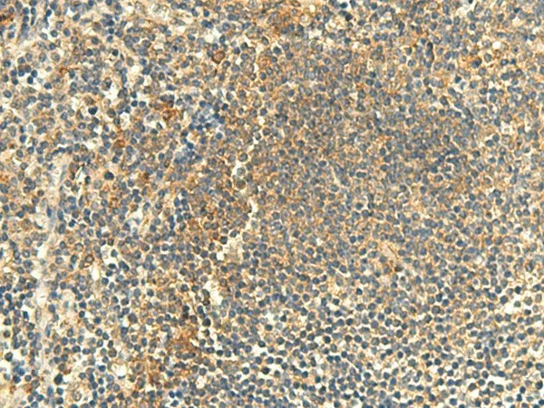 CLEC4D Polyclonal Antibody - image 1