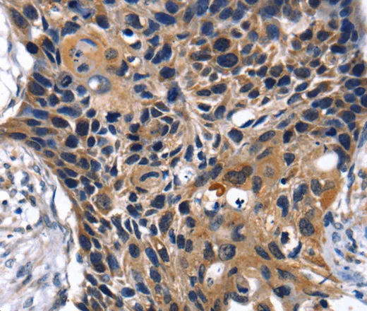 SLC2A2 Polyclonal Antibody - image 1