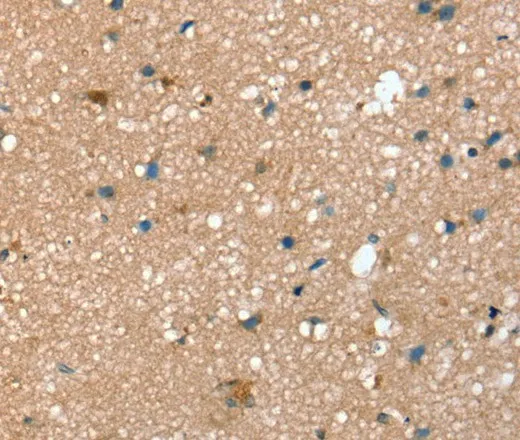 STX2 Polyclonal Antibody - image 2