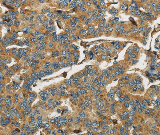 AIF1 Polyclonal Antibody - image 1
