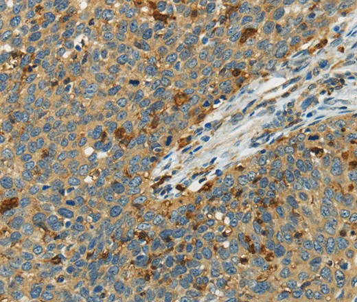 AIF1 Polyclonal Antibody - image 2