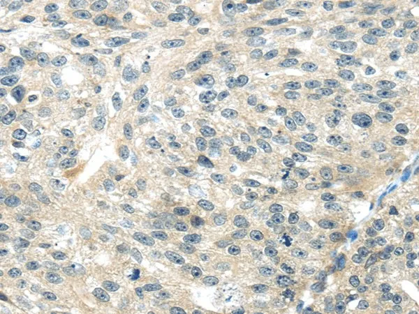 TRAIP Polyclonal Antibody - image 1