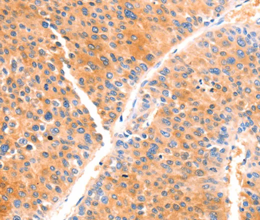PRDX2 Polyclonal Antibody - image 1