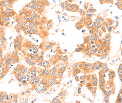 PRDX2 Polyclonal Antibody - image 2
