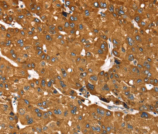 RASSF3 Polyclonal Antibody - image 1