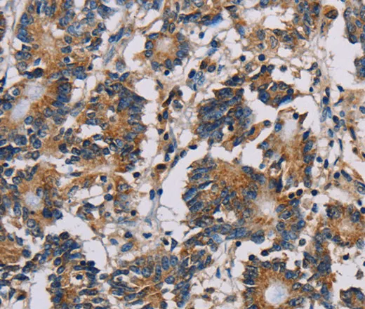 MRPL39 Polyclonal Antibody - image 1