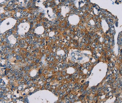 MRPL39 Polyclonal Antibody - image 2