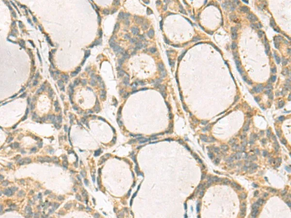 KIF2C Polyclonal Antibody - image 1