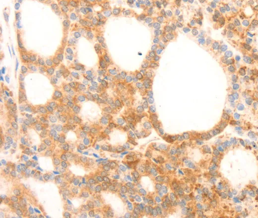 NAP1L1 Polyclonal Antibody - image 2