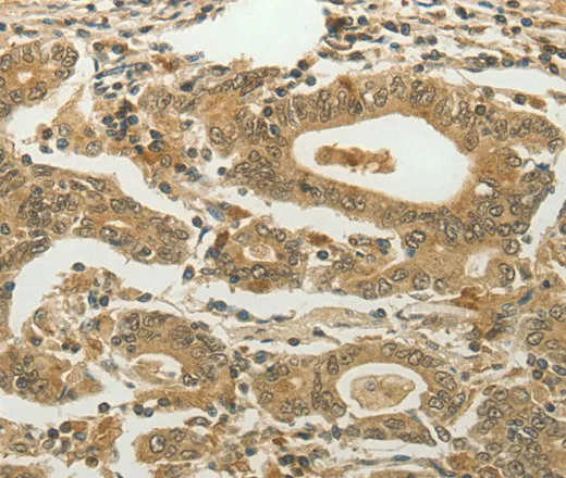 MYSM1 Polyclonal Antibody - image 1