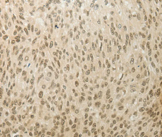 MYSM1 Polyclonal Antibody - image 2