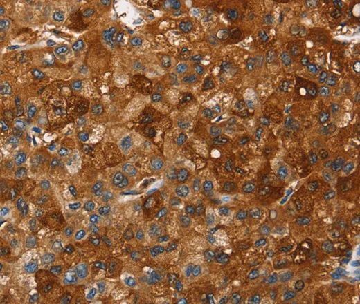 PAK2 Polyclonal Antibody - image 1