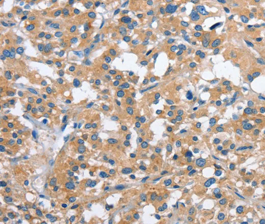 PAK2 Polyclonal Antibody - image 2