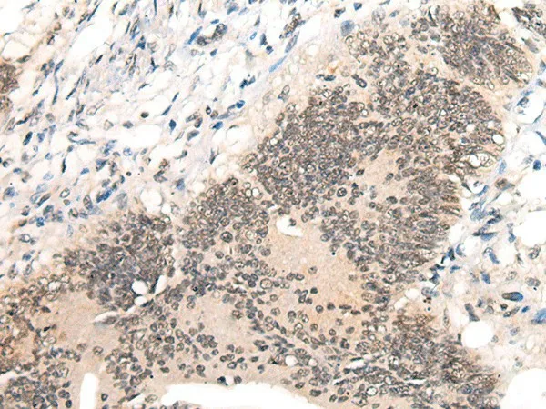 AURKA Polyclonal Antibody - image 1