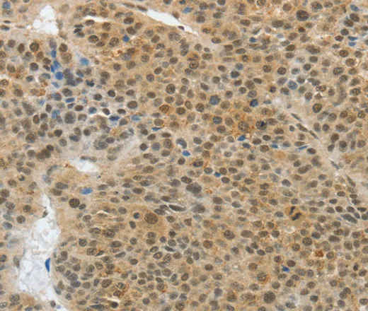 ASH2L Polyclonal Antibody - image 1