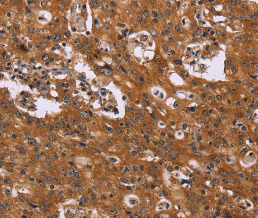 CMTM6 Polyclonal Antibody - image 1