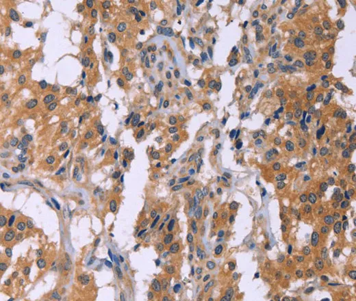 CMTM6 Polyclonal Antibody - image 2