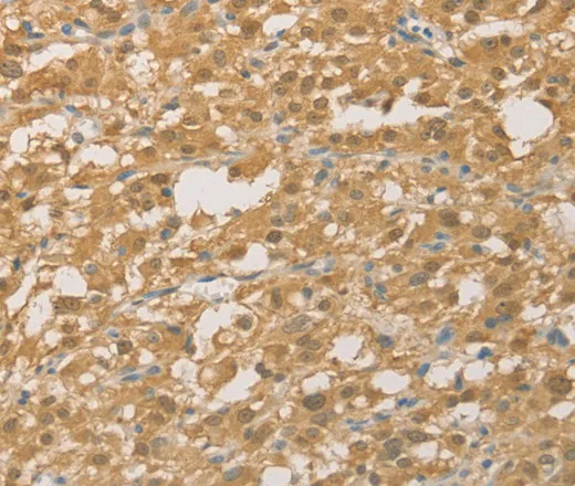 PGK2 Polyclonal Antibody - image 1