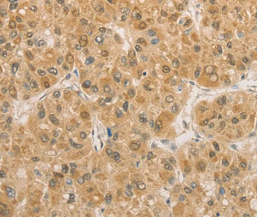 PGK2 Polyclonal Antibody - image 2