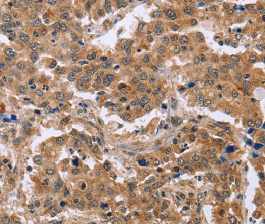 EPDR1 Polyclonal Antibody - image 1