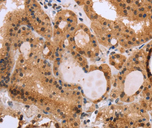 EPDR1 Polyclonal Antibody - image 2