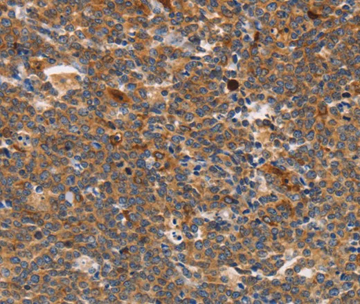 STK4 Polyclonal Antibody - image 1