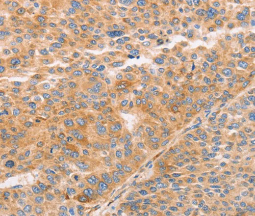 STK4 Polyclonal Antibody - image 2