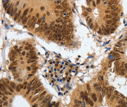 COPS5 Polyclonal Antibody - image 1