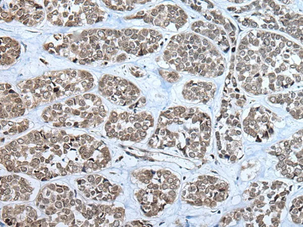 RPF2 Polyclonal Antibody - image 1