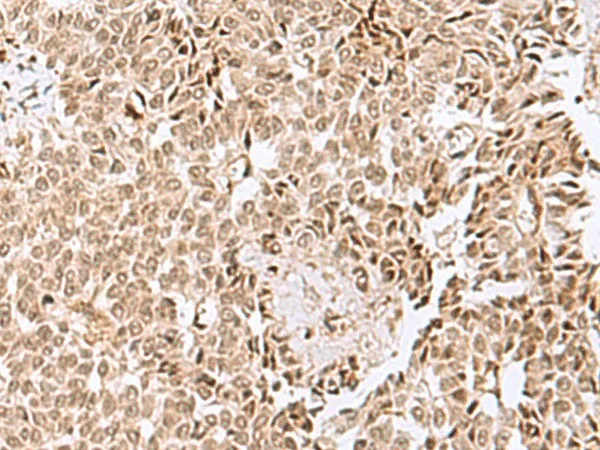 ELAC1 Polyclonal Antibody - image 1