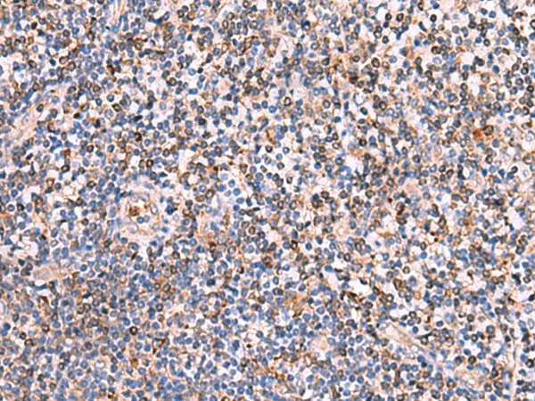 SOX2 Polyclonal Antibody - image 1