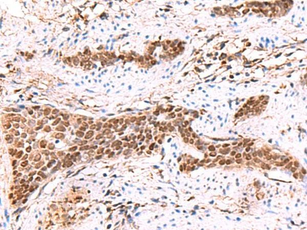 SOX2 Polyclonal Antibody - image 2