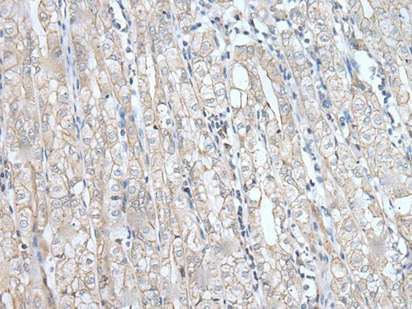 SPTA1 Polyclonal Antibody - image 1
