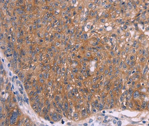 EMP2 Polyclonal Antibody - image 1