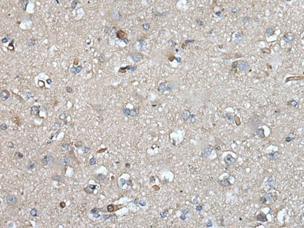 UMPS Polyclonal Antibody - image 1