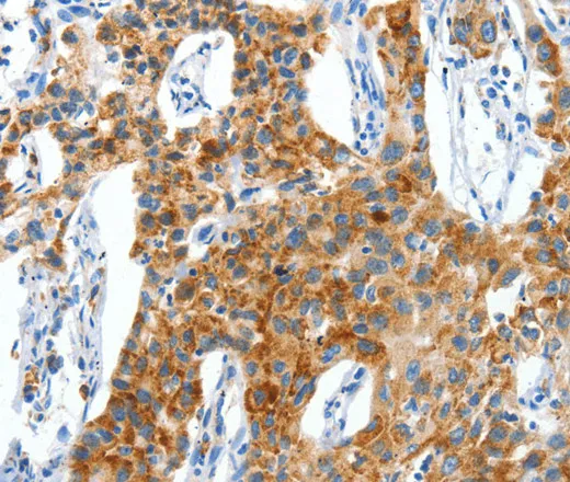 CKAP4 Polyclonal Antibody - image 1