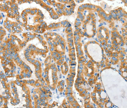 CKAP4 Polyclonal Antibody - image 2
