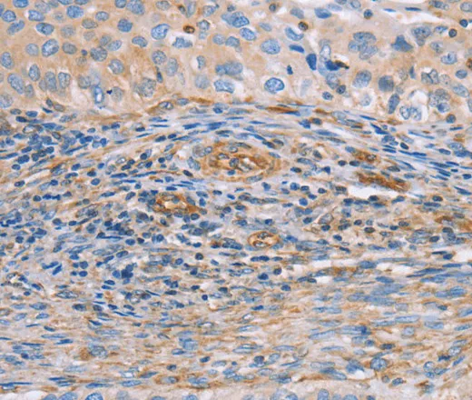 NRG4 Polyclonal Antibody - image 1