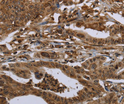 HPGD Polyclonal Antibody - image 1